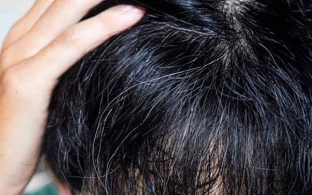 wellhealthorganic.com/know-the-causes-of-white-hair-and-easy-ways-to-prevent-it-naturally